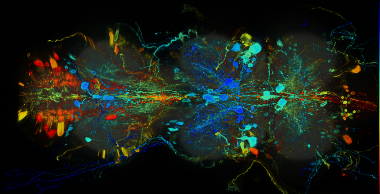 P{GMR14G10-GAL4} expression pattern