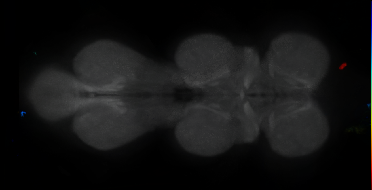 P{GMR14G11-GAL4} expression pattern