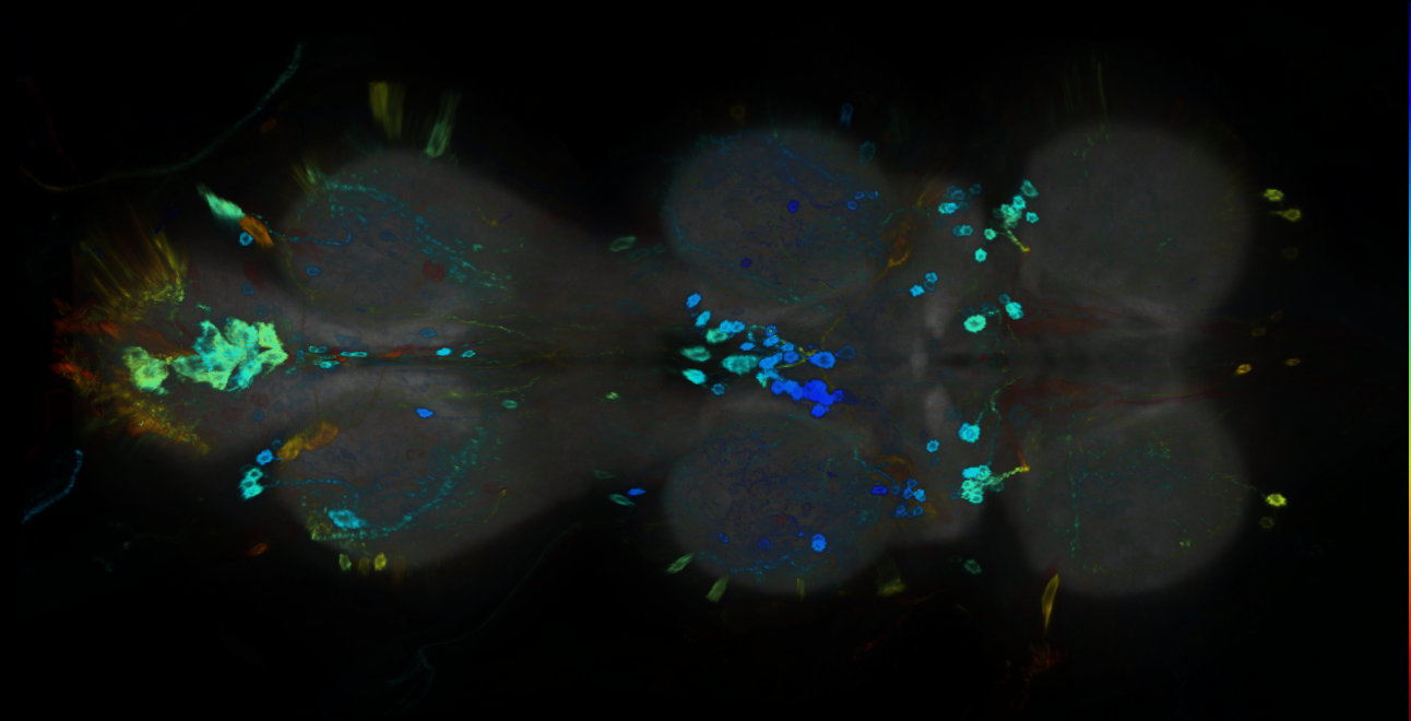 P{GMR14H01-GAL4} expression pattern