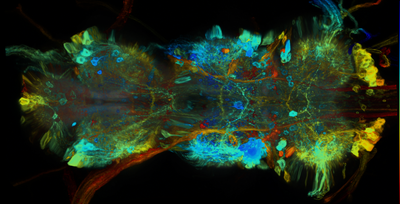P{GMR14H02-GAL4} expression pattern