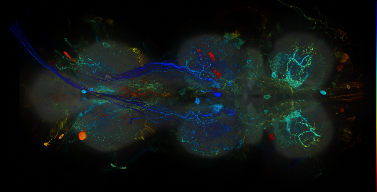 P{GMR14H06-GAL4} expression pattern