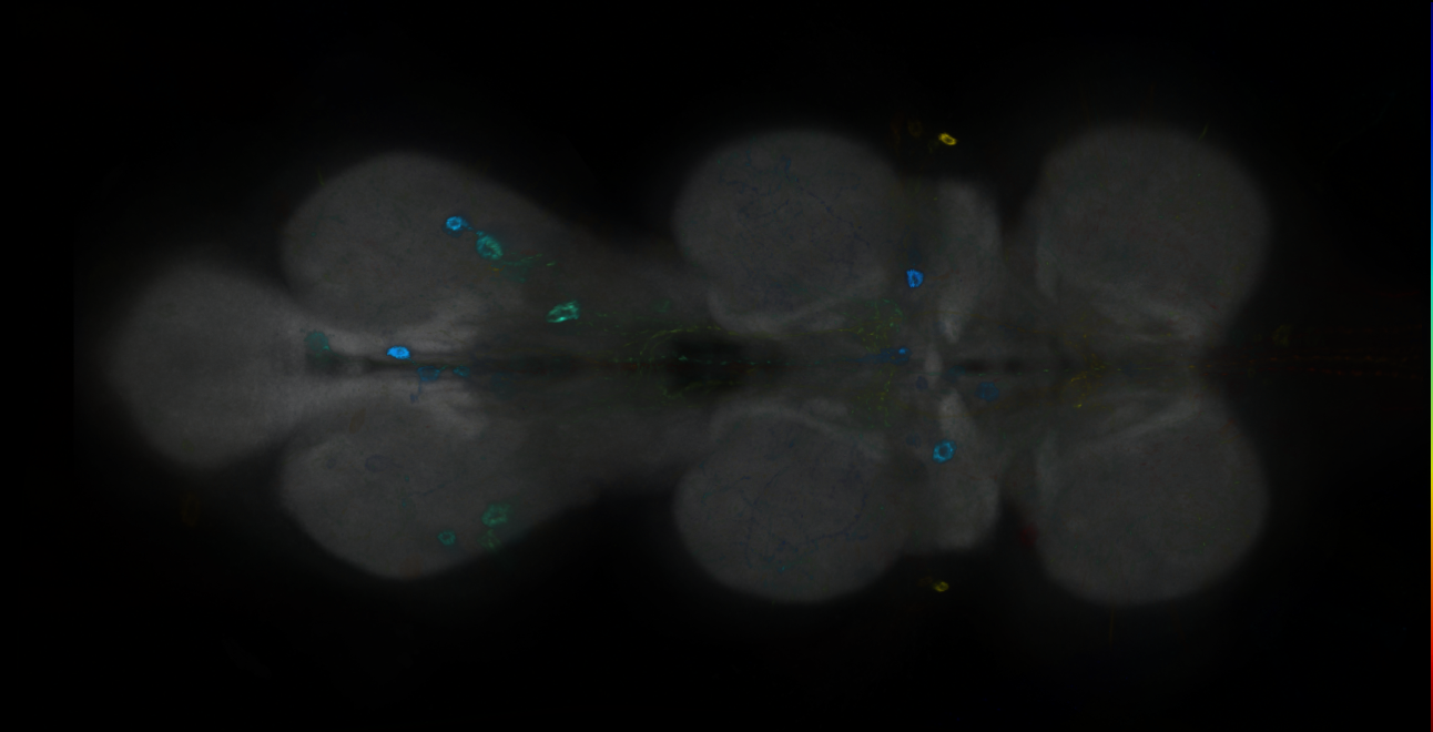 P{GMR14H07-GAL4} expression pattern