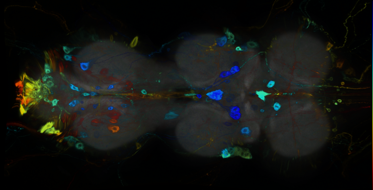 P{GMR14H08-GAL4} expression pattern