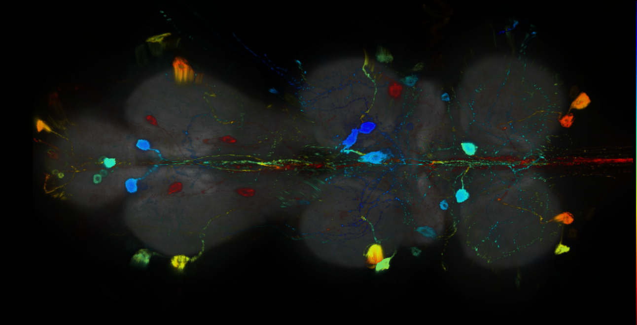 P{GMR14H09-GAL4} expression pattern
