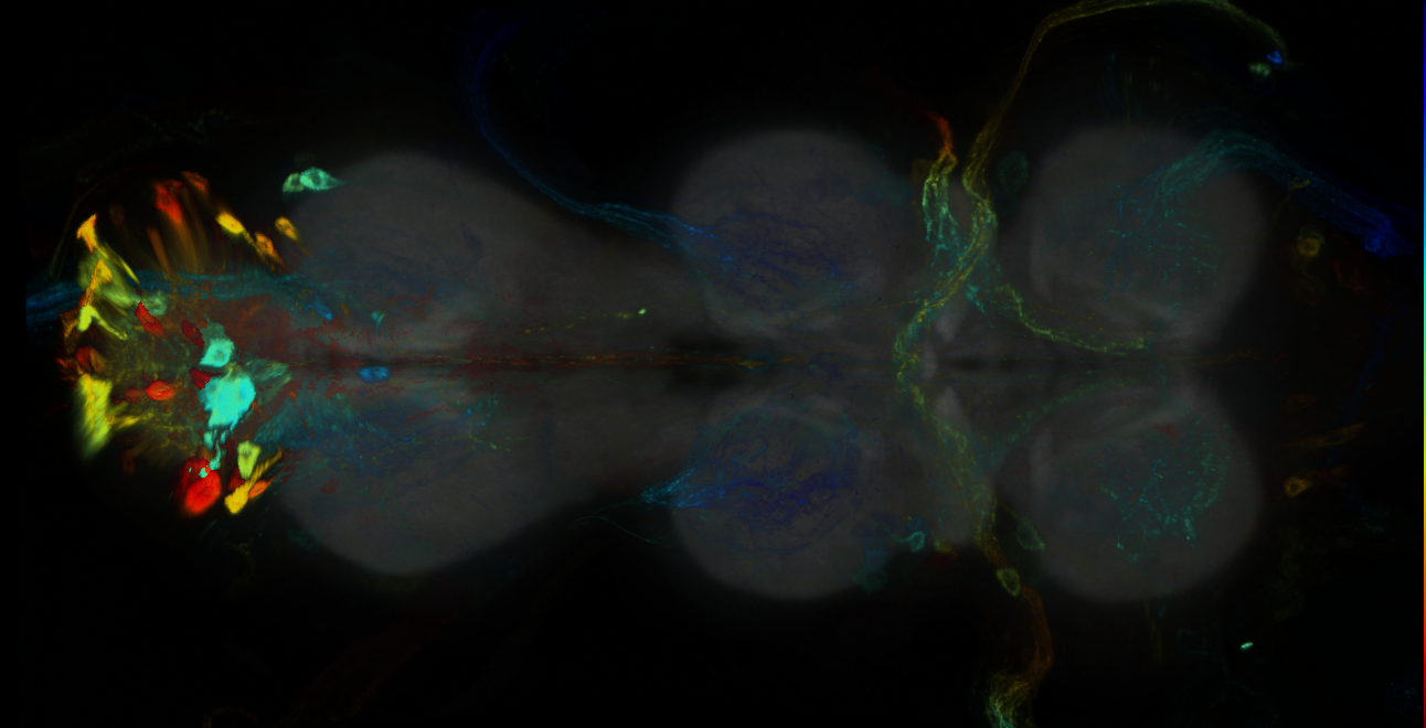 P{GMR14H11-GAL4} expression pattern