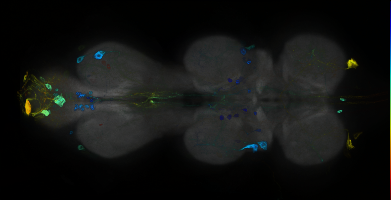 P{GMR15A01-GAL4} expression pattern