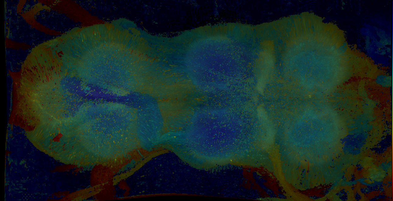 P{GMR15A02-GAL4} expression pattern