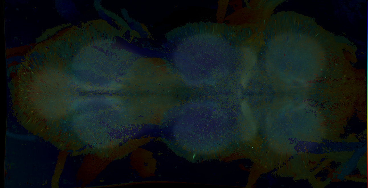 P{GMR15A03-GAL4} expression pattern