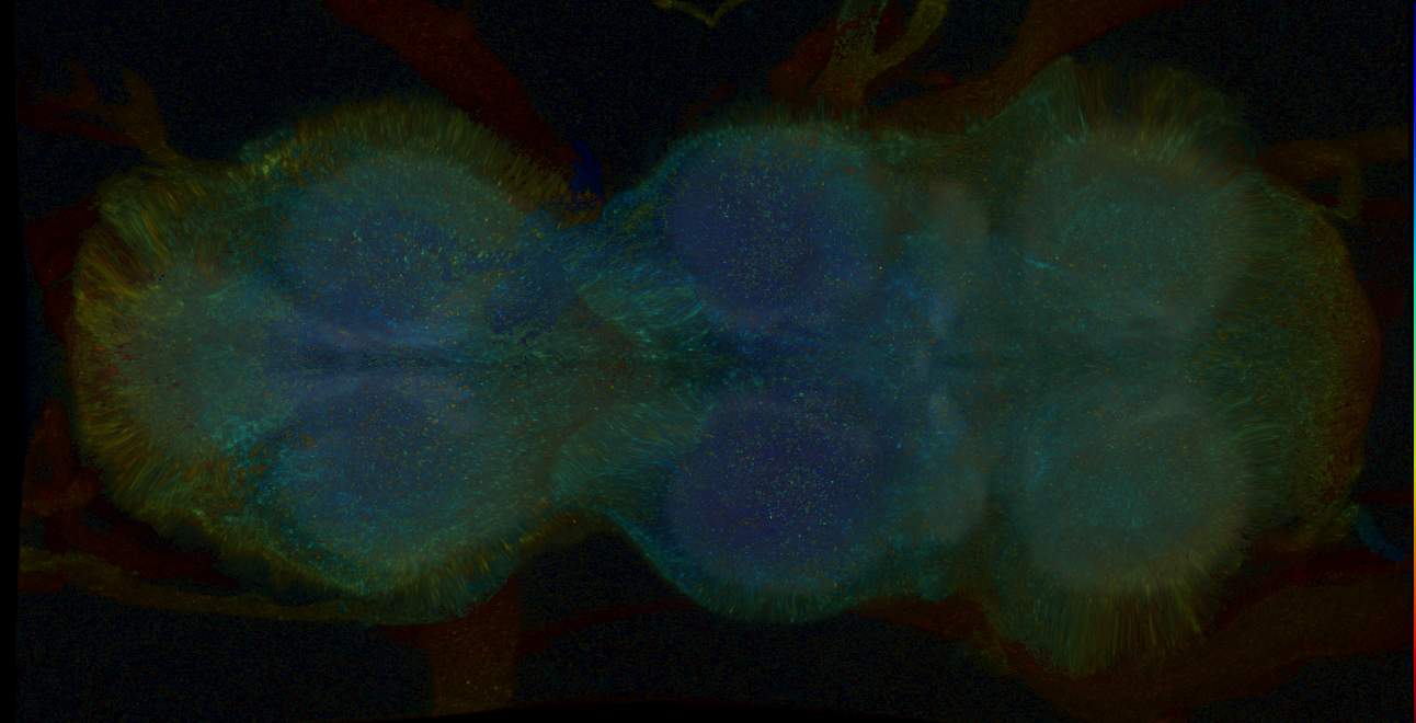 P{GMR15A10-GAL4} expression pattern