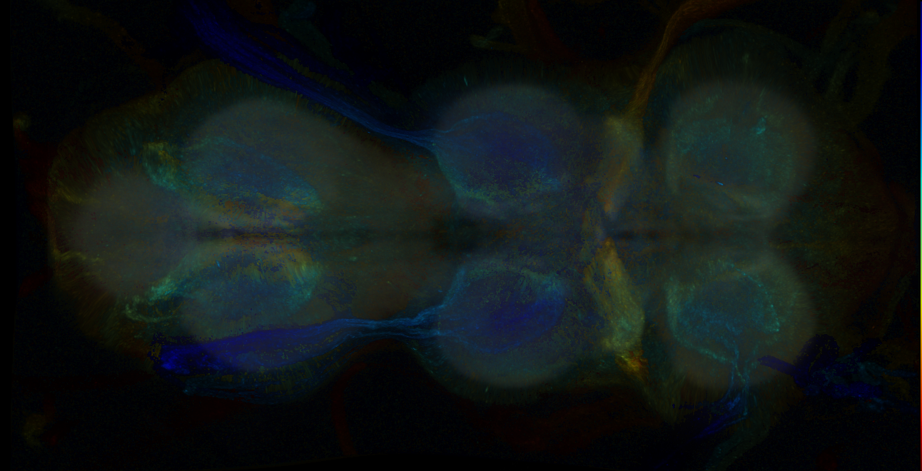 P{GMR15A11-GAL4} expression pattern