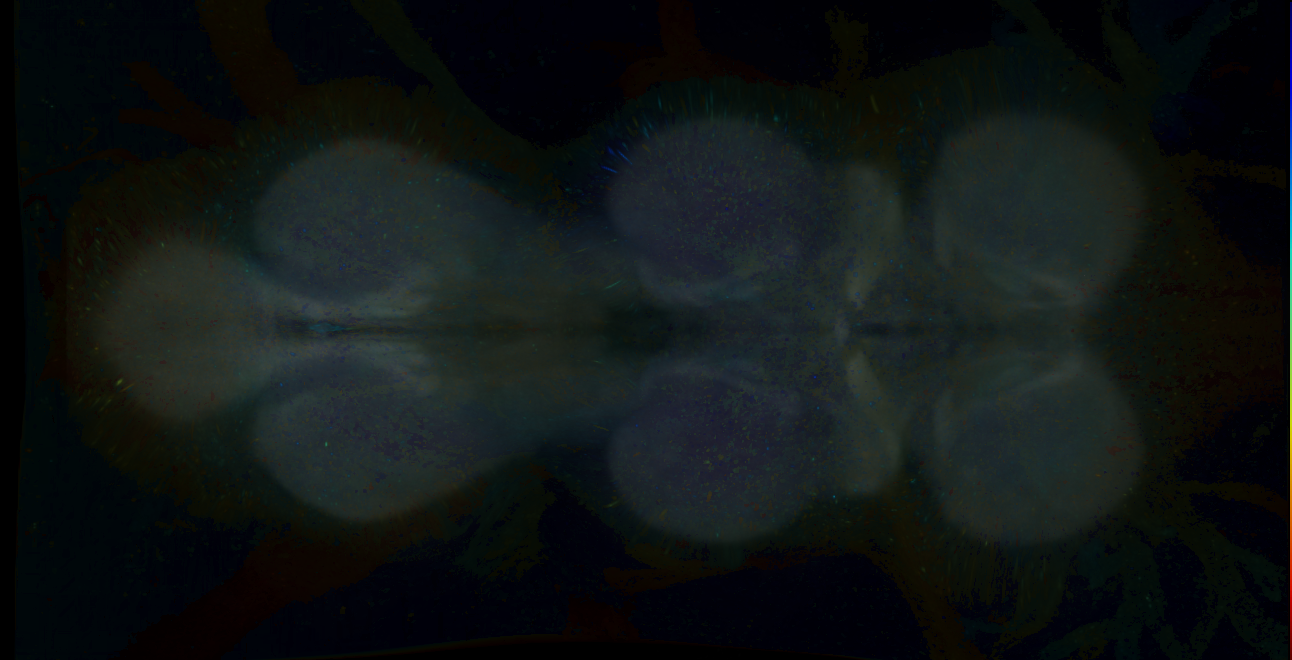 P{GMR15B02-GAL4} expression pattern