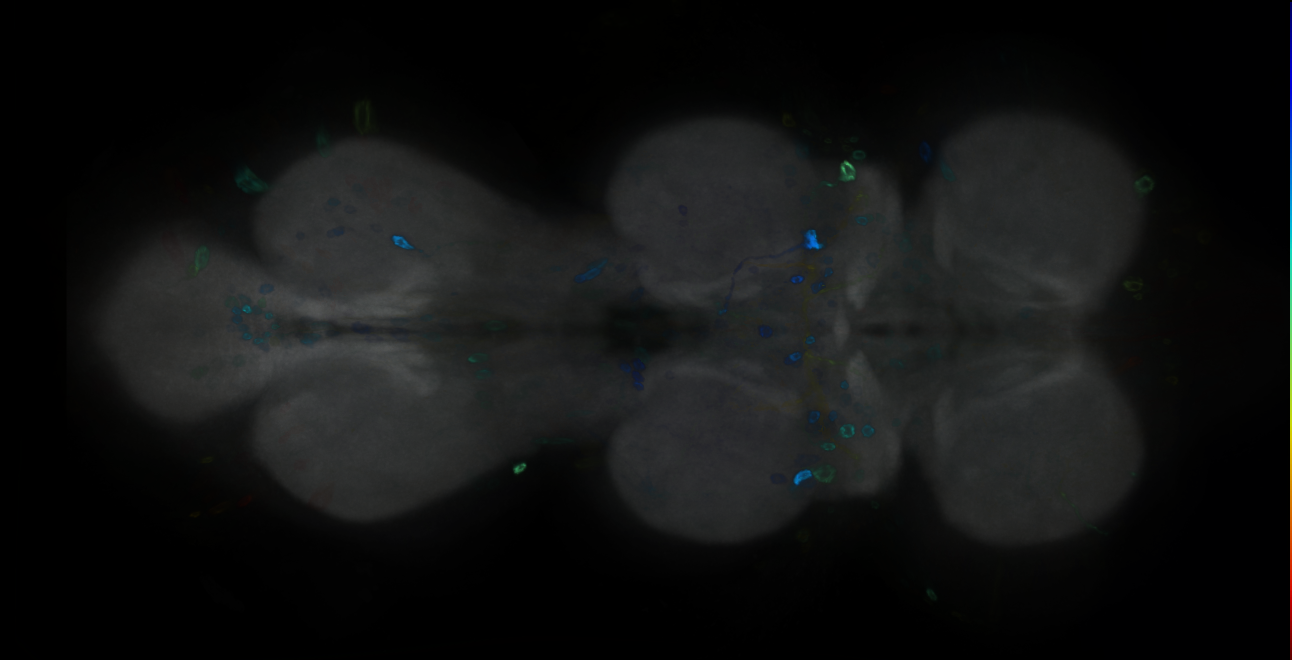 P{GMR15B04-GAL4} expression pattern