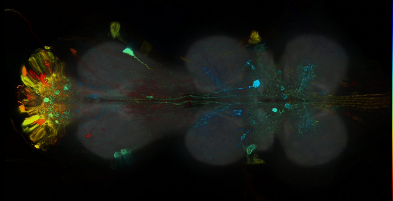 P{GMR15B06-GAL4} expression pattern