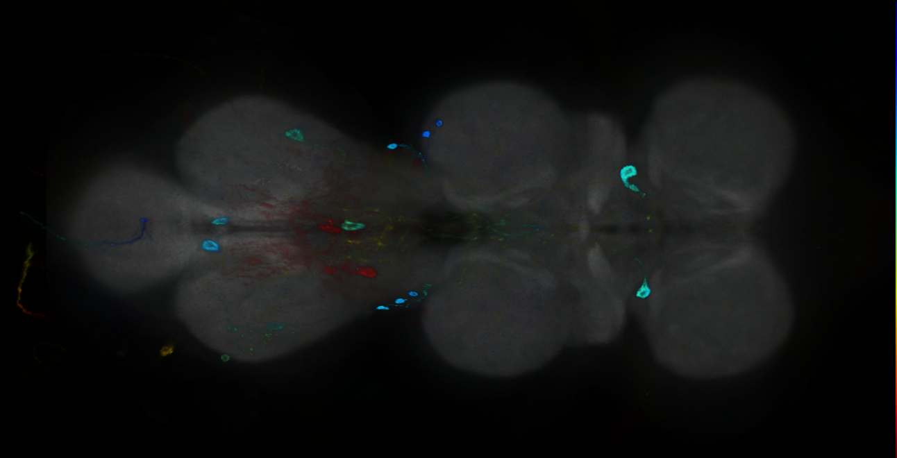 P{GMR15B10-GAL4} expression pattern