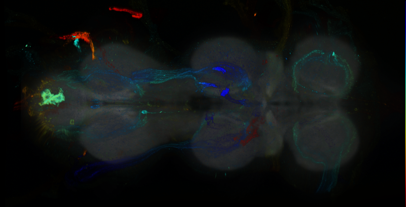 P{GMR15C03-GAL4} expression pattern
