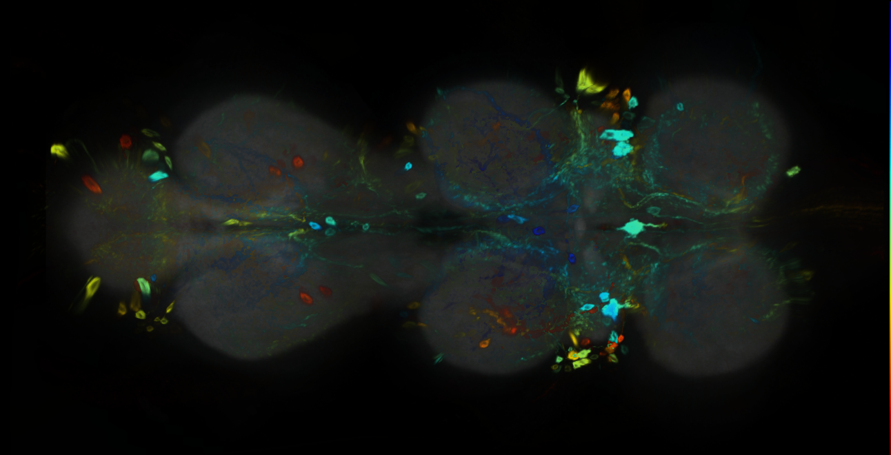 P{GMR15C07-GAL4} expression pattern