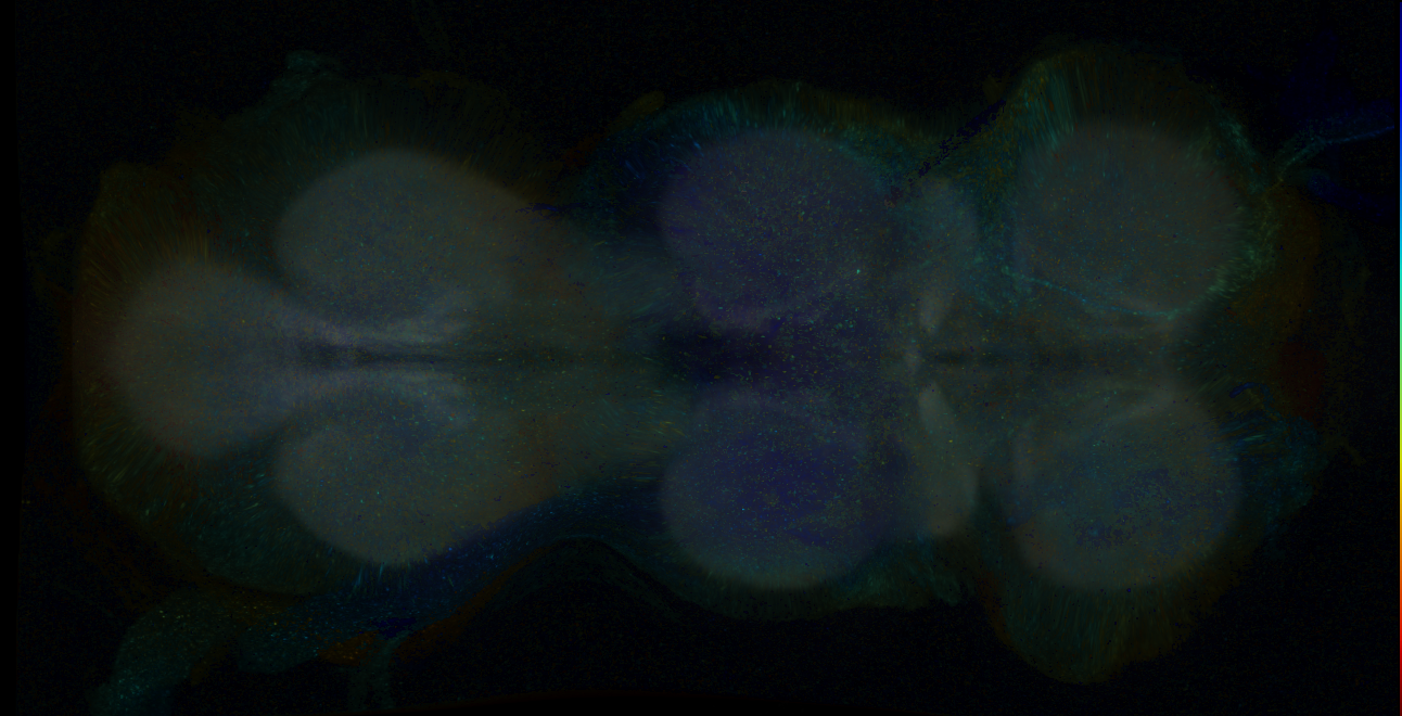 P{GMR15C09-GAL4} expression pattern