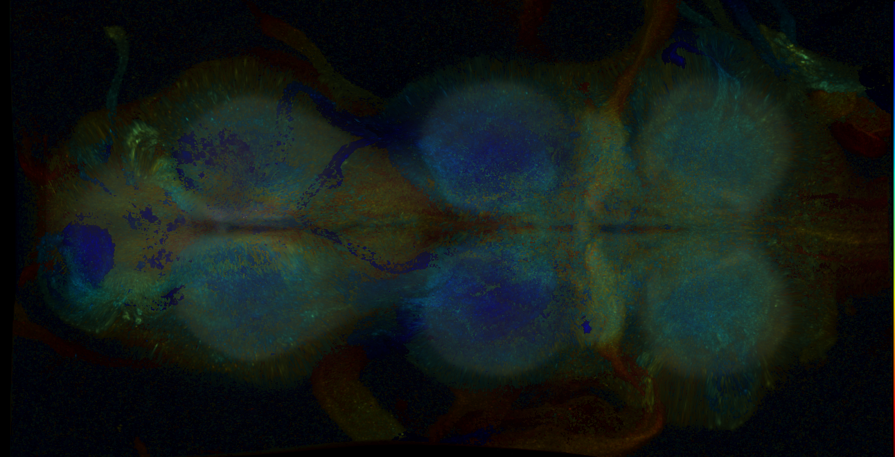 P{GMR15C10-GAL4} expression pattern