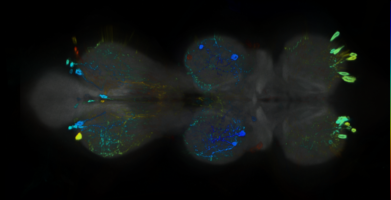 P{GMR15C11-GAL4} expression pattern