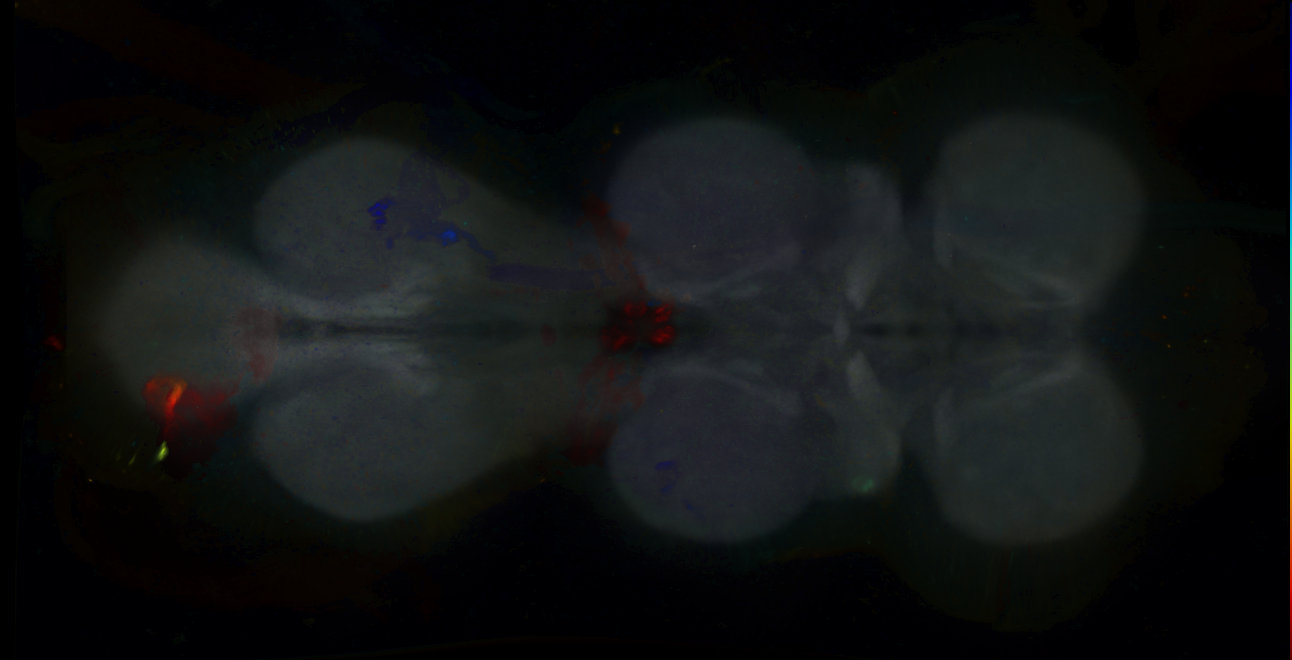 P{GMR15D02-GAL4} expression pattern