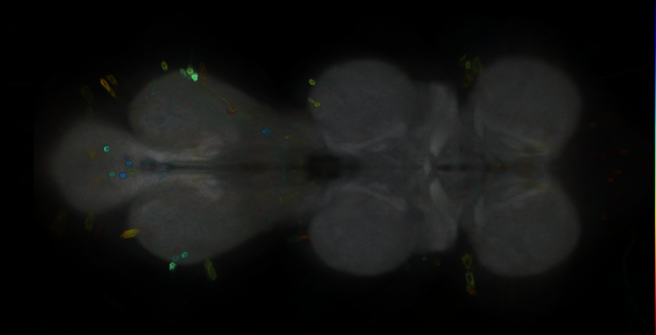 P{GMR15D10-GAL4} expression pattern
