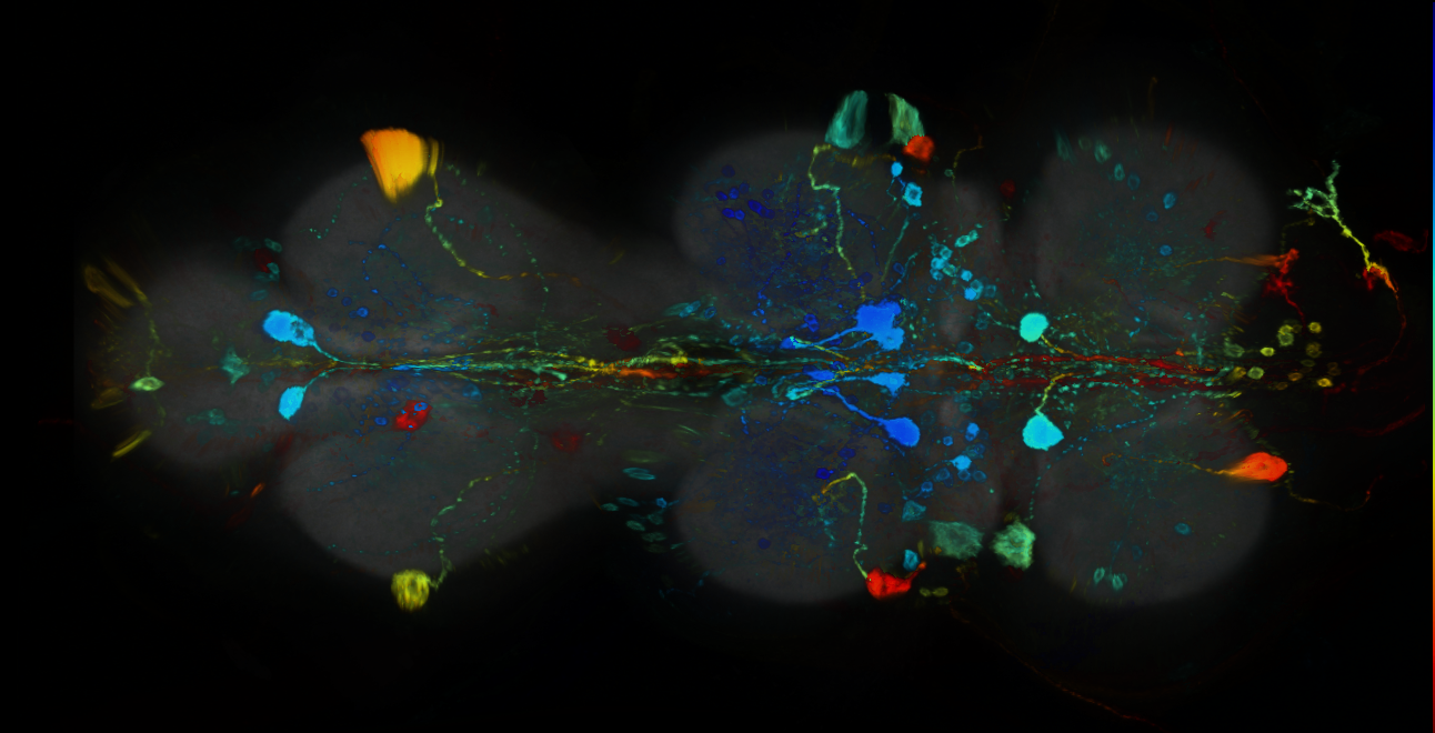 P{GMR15D11-GAL4} expression pattern