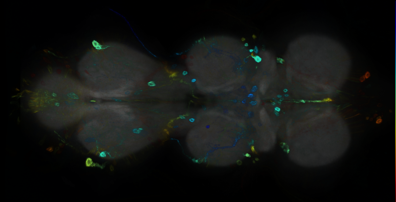 P{GMR15E02-GAL4} expression pattern