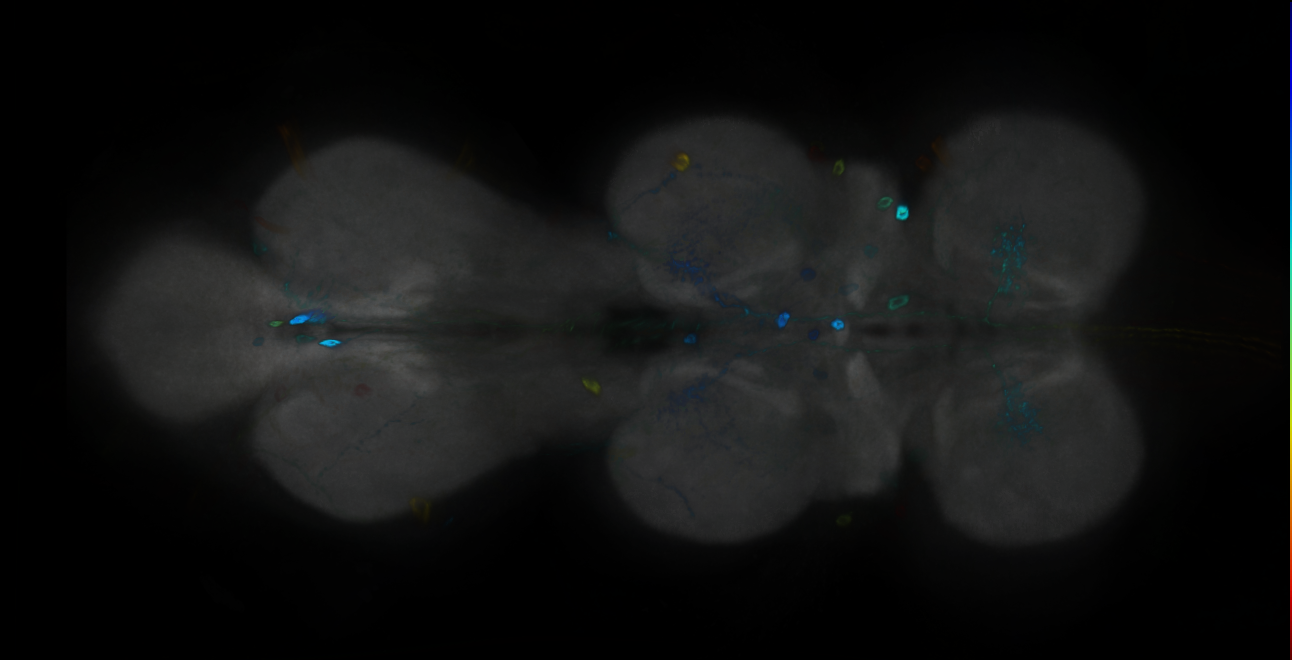 P{GMR15E06-GAL4} expression pattern
