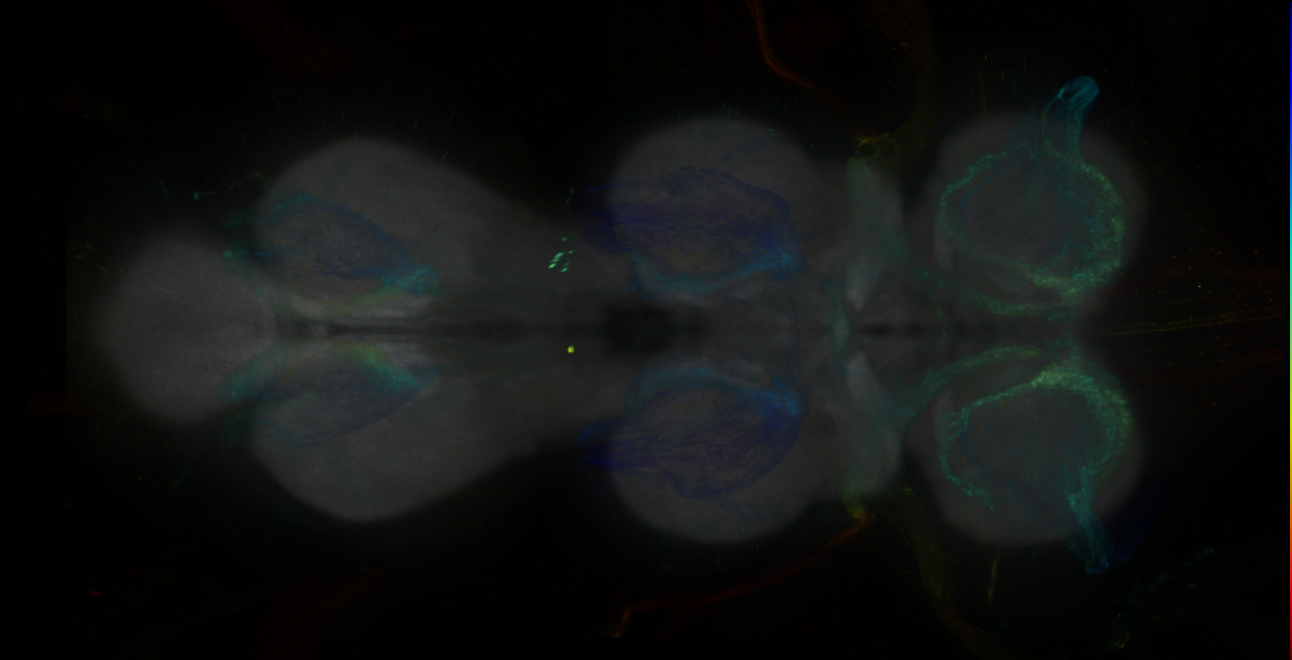 P{GMR15E09-GAL4} expression pattern