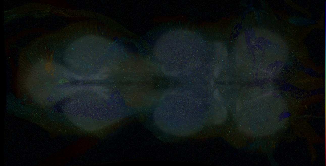 P{GMR15F05-GAL4} expression pattern