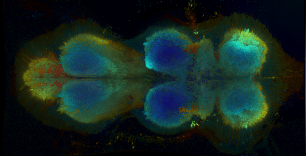 P{GMR15F06-GAL4} expression pattern