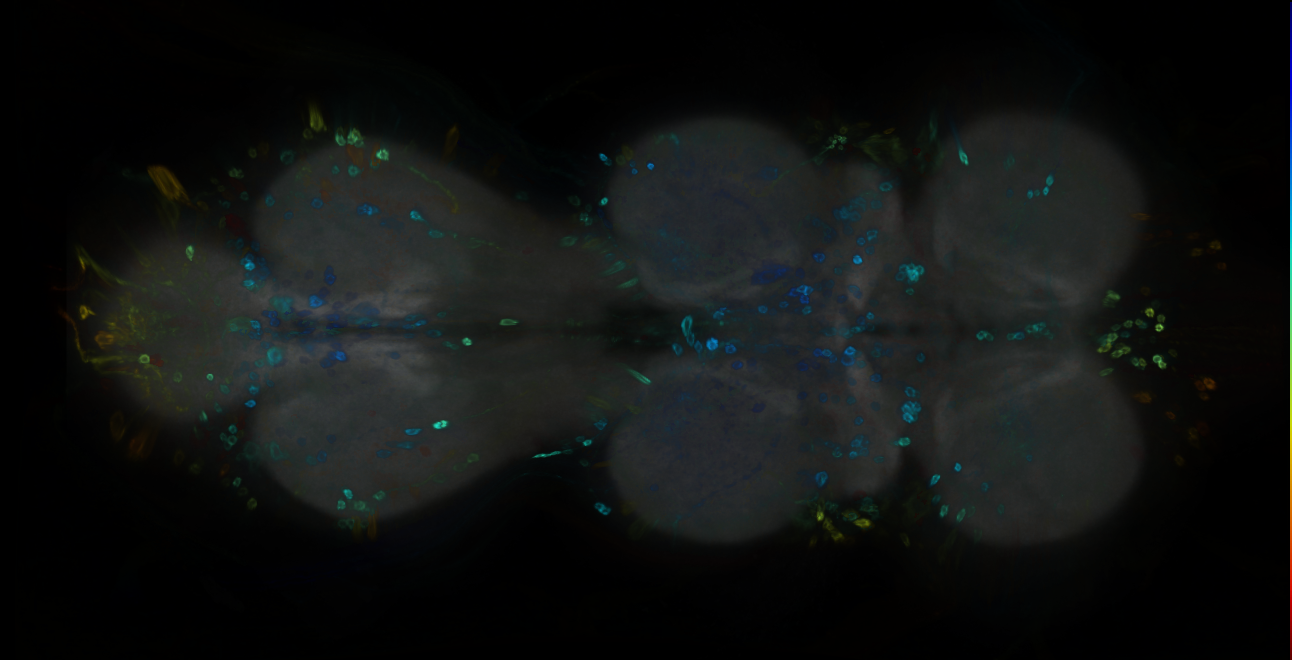 P{GMR15F07-GAL4} expression pattern