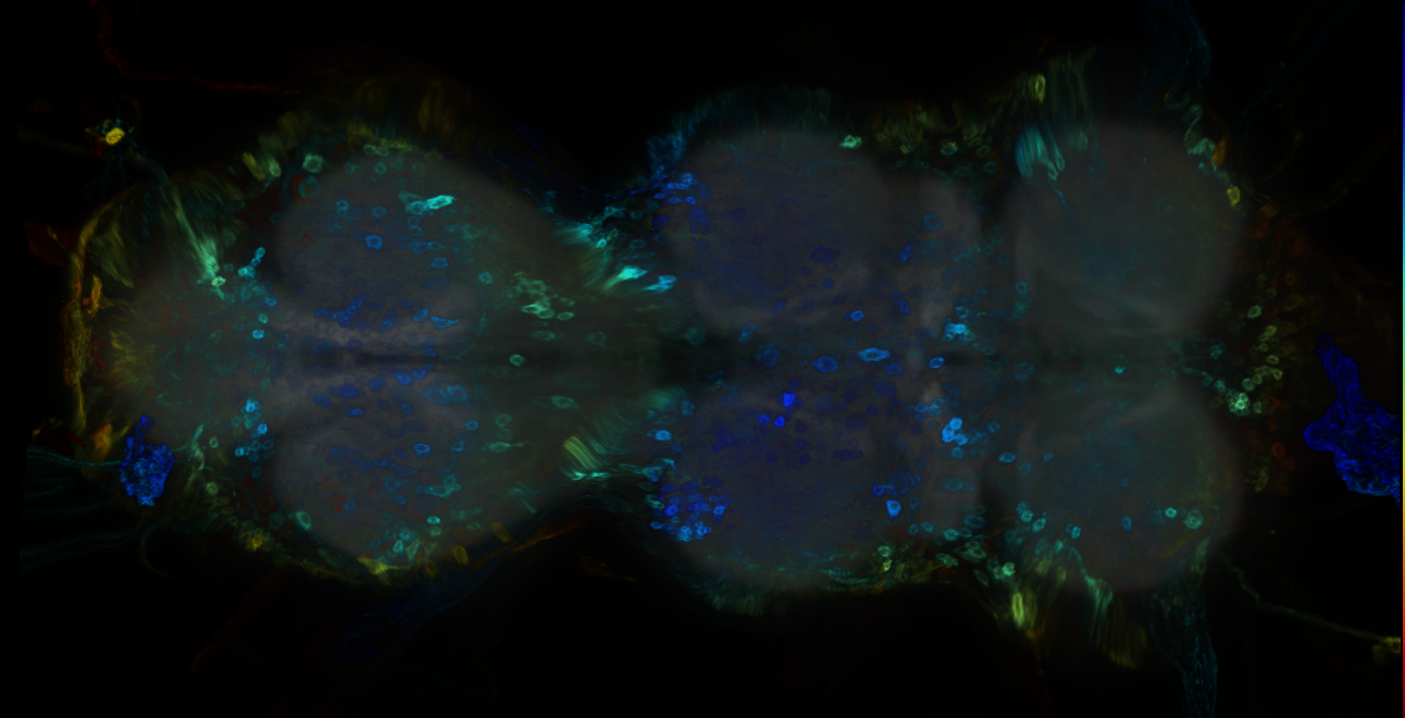 P{GMR15F11-GAL4} expression pattern