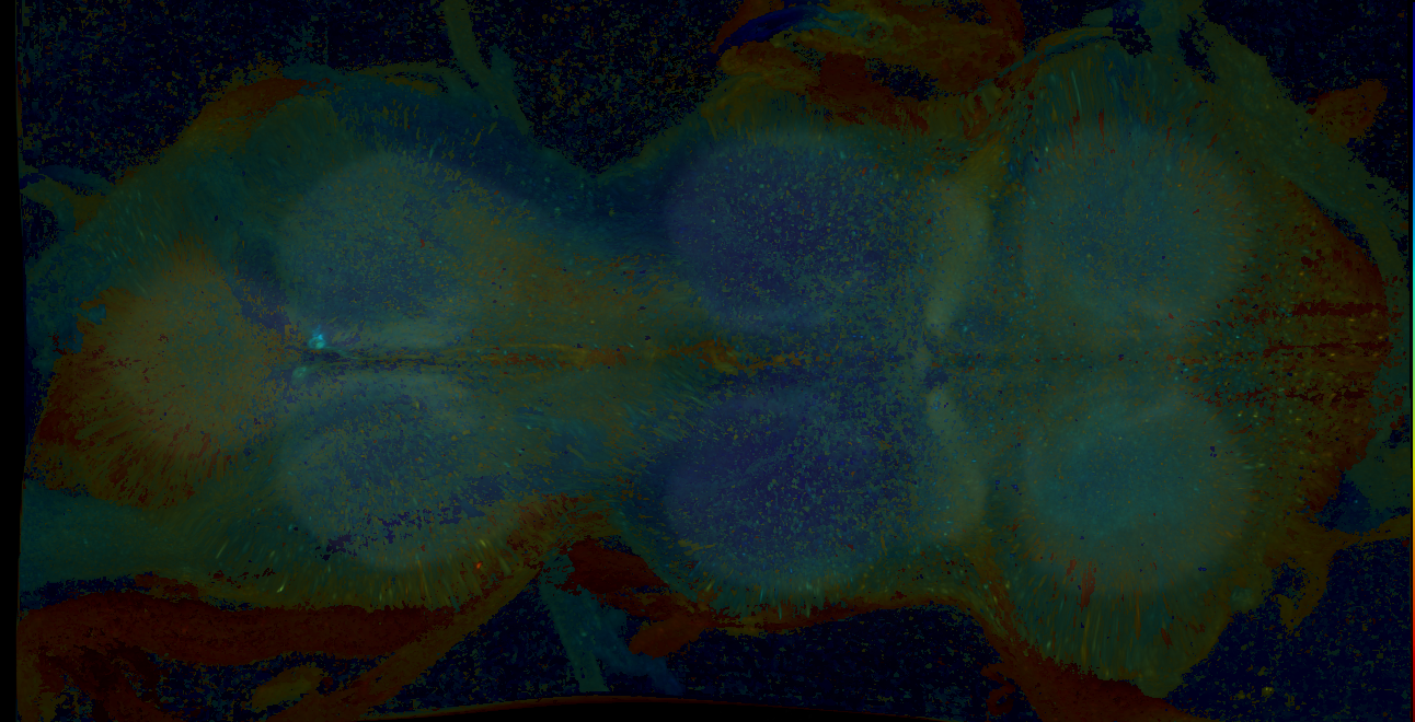 P{GMR15G03-GAL4} expression pattern