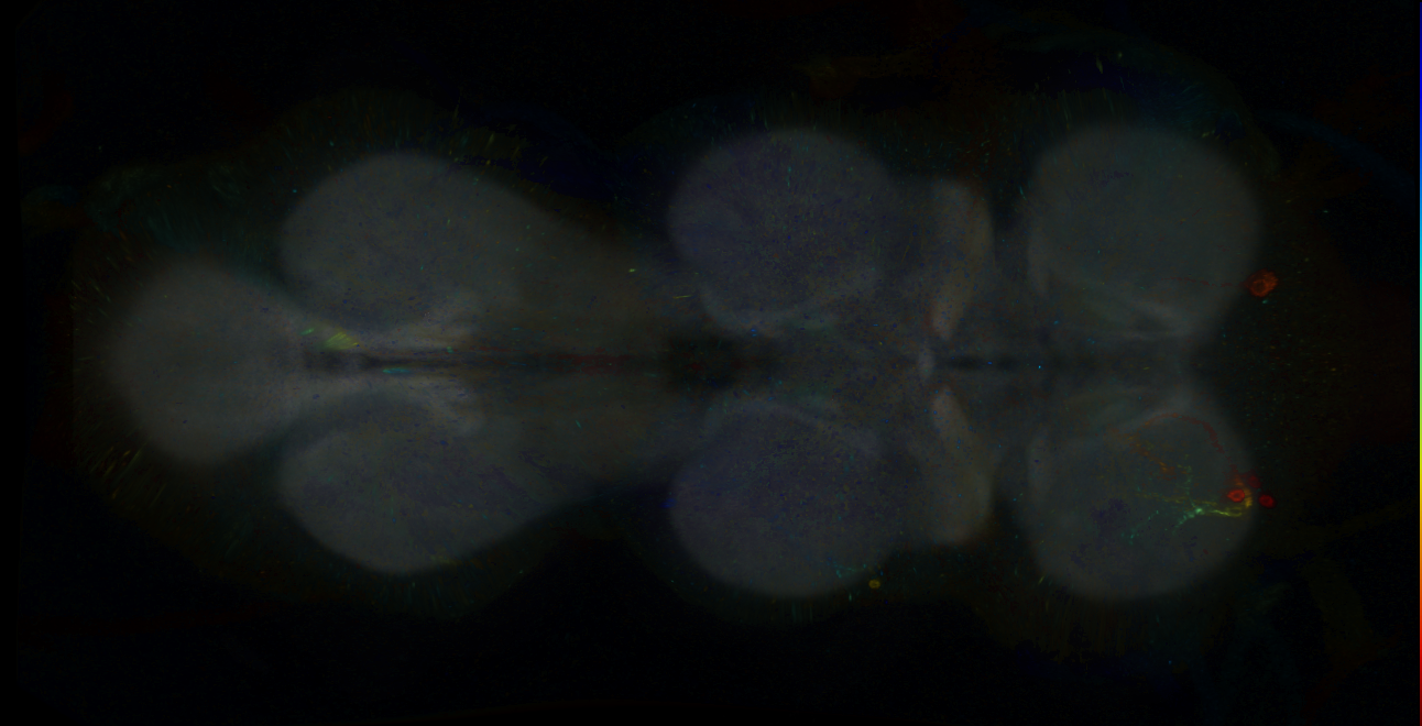 P{GMR15G06-GAL4} expression pattern