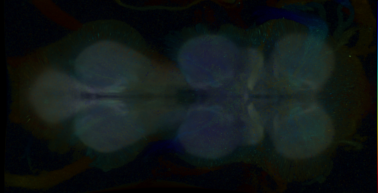P{GMR15G07-GAL4} expression pattern