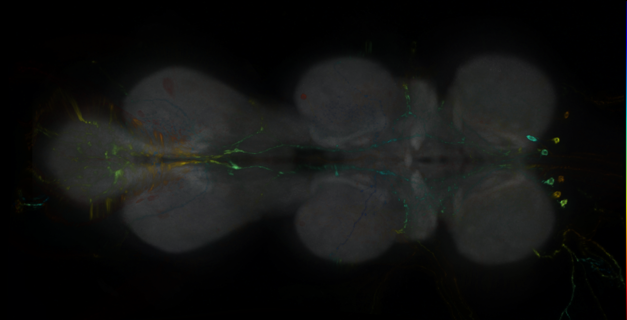 P{GMR15G08-GAL4} expression pattern
