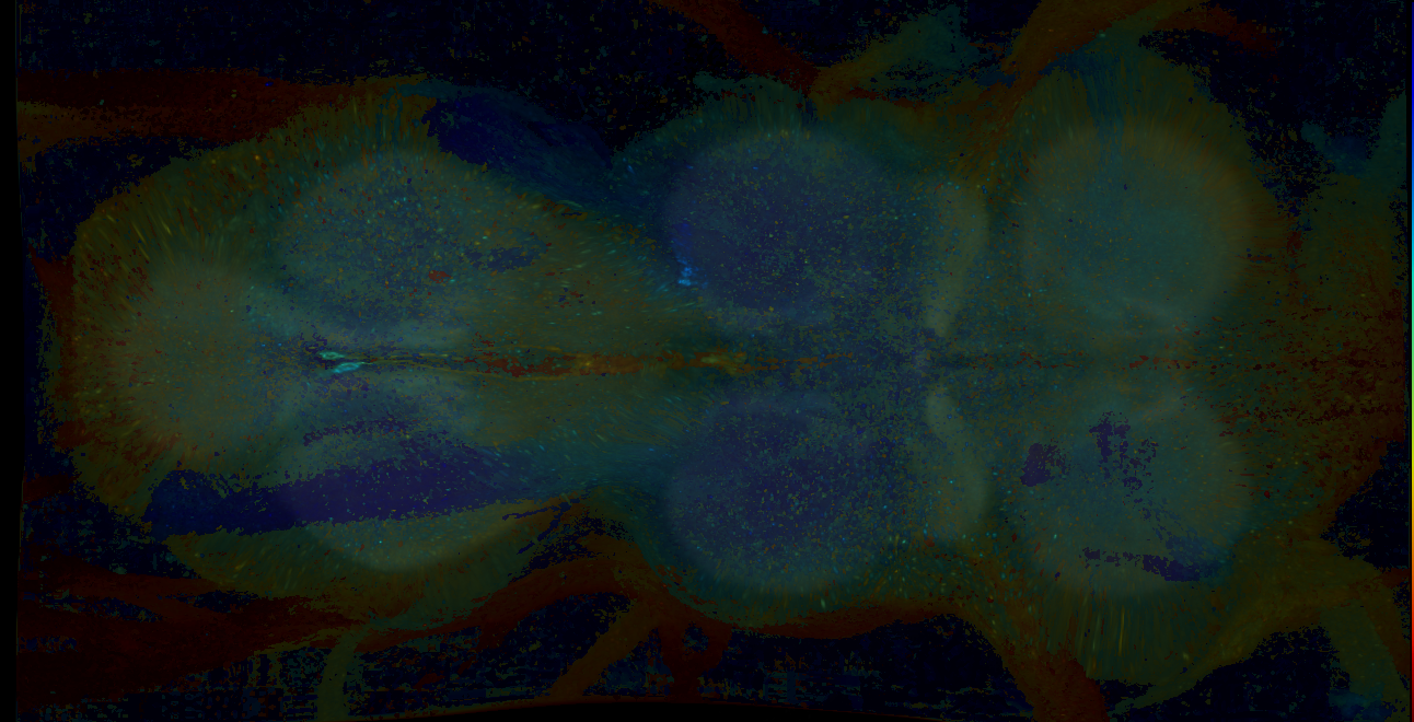 P{GMR15G11-GAL4} expression pattern
