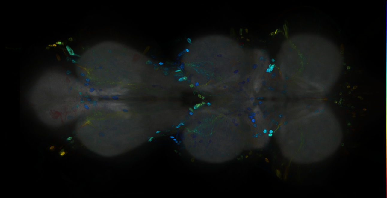 P{GMR15H01-GAL4} expression pattern