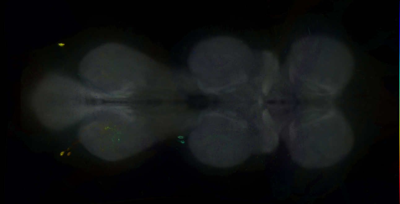 P{GMR15H02-GAL4} expression pattern