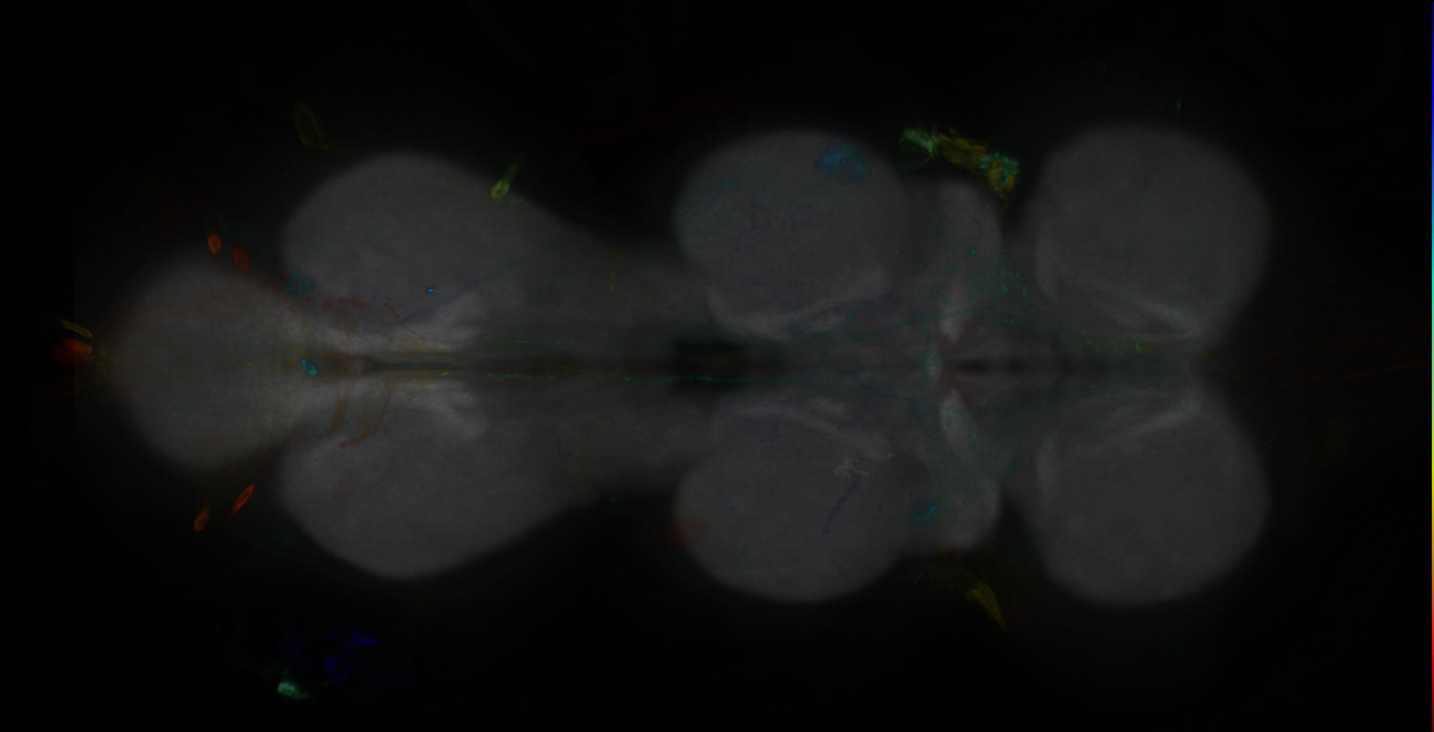 P{GMR15H04-GAL4} expression pattern