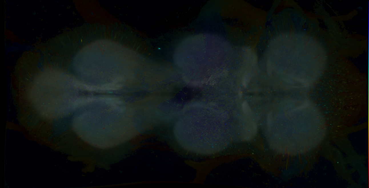 P{GMR15H05-GAL4} expression pattern