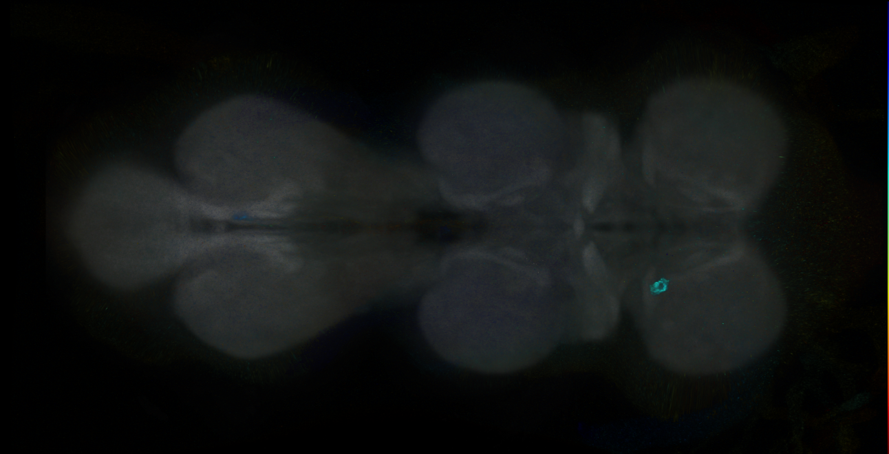 P{GMR15H06-GAL4} expression pattern