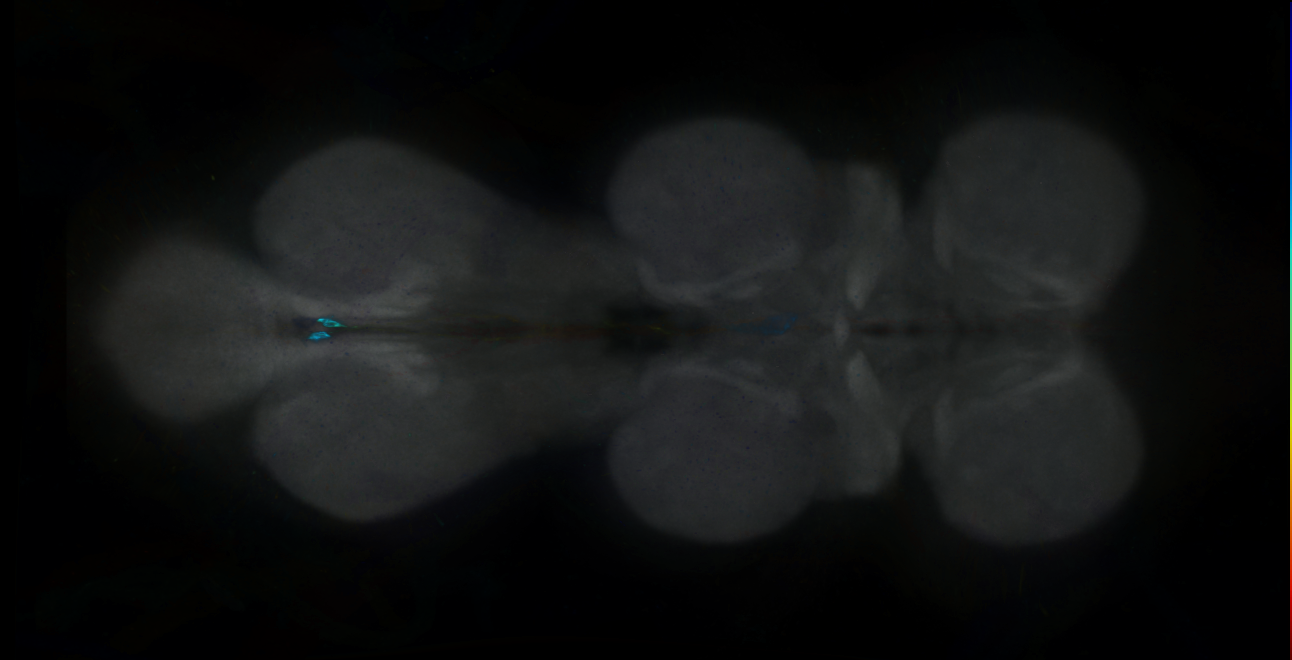 P{GMR15H07-GAL4} expression pattern