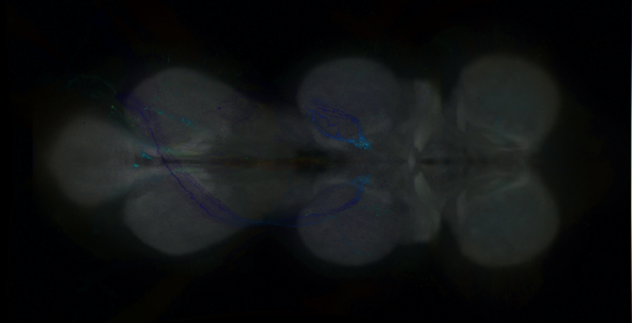 P{GMR15H09-GAL4} expression pattern