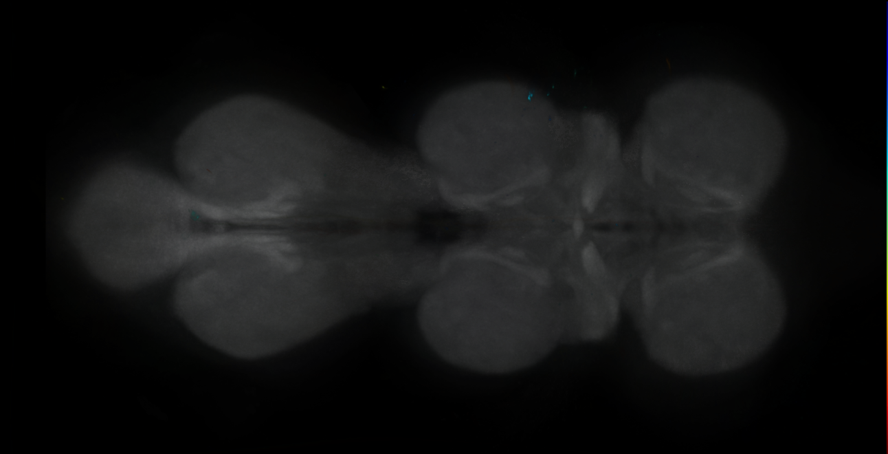 P{GMR15H11-GAL4} expression pattern