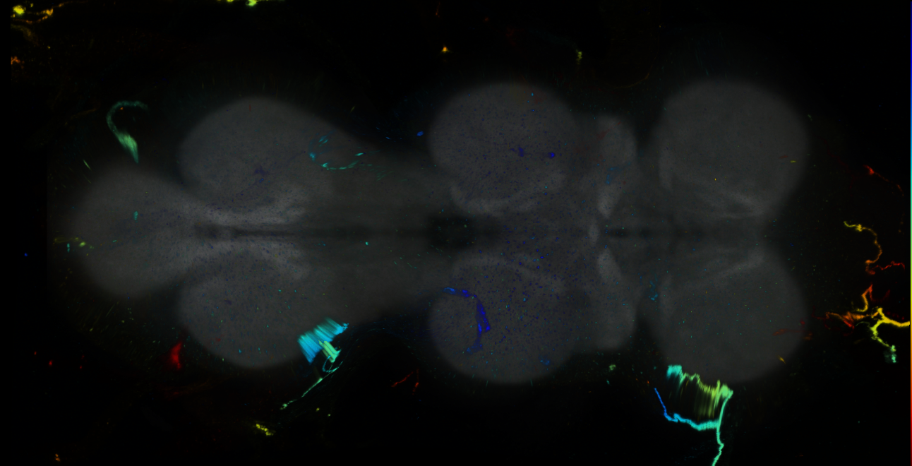 P{GMR16G11-GAL4} expression pattern