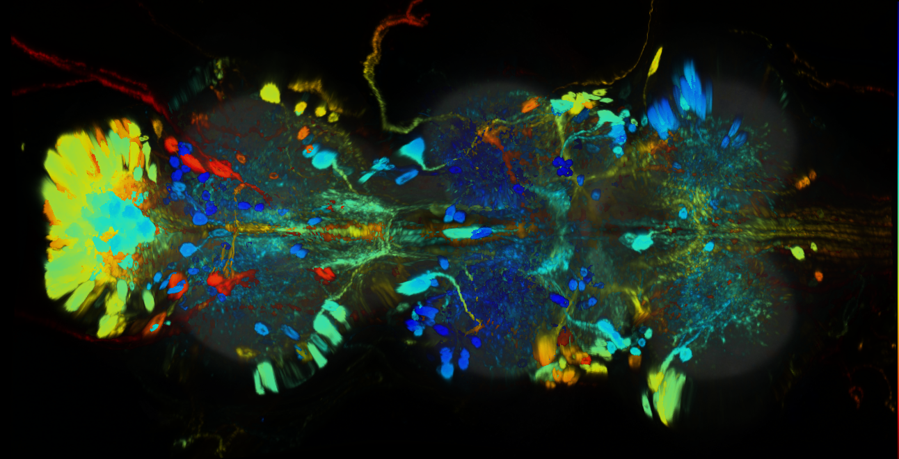 P{GMR17A06-GAL4} expression pattern