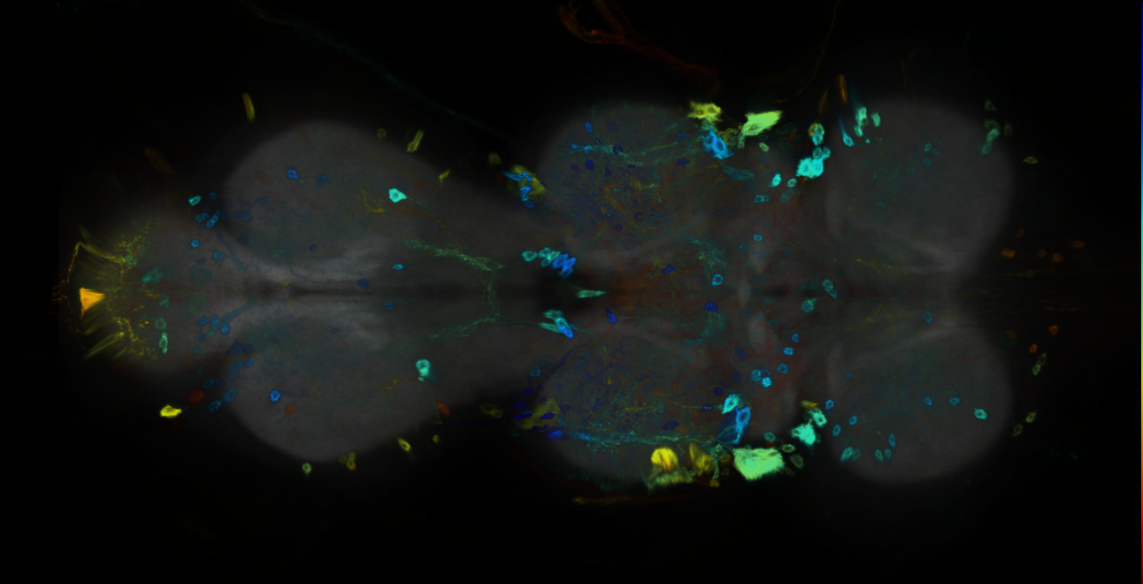P{GMR17A07-GAL4} expression pattern
