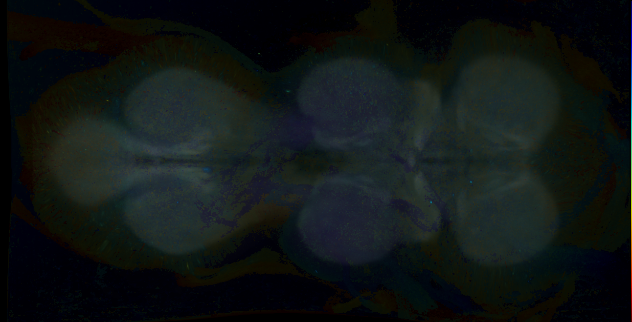 P{GMR17A08-GAL4} expression pattern